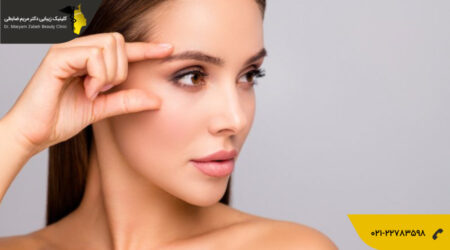 ابروهای خانمی پس از عمل لیفت