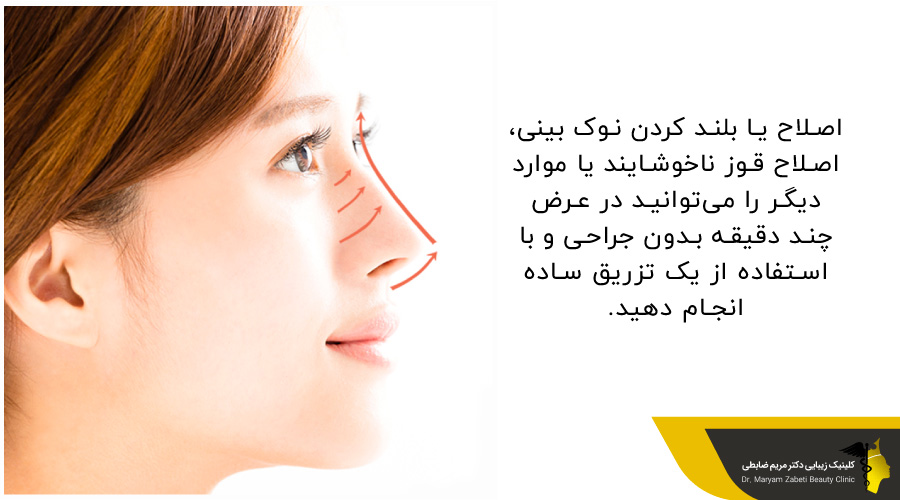 بینی لیفت شده
