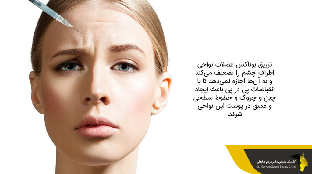 لیفت چشم