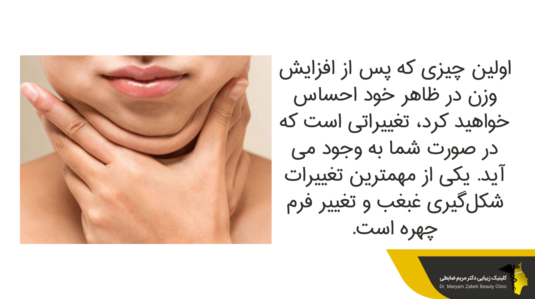 شکل‌گیری غبغب و تغییر فرم چهره