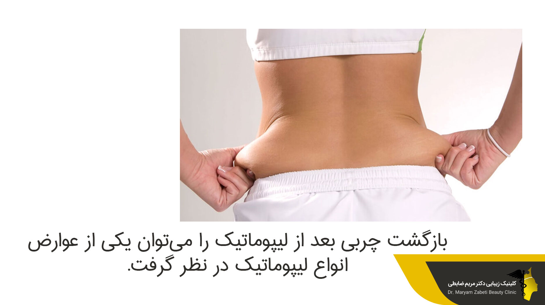  بازگشت چربی بعد از لیپوماتیک