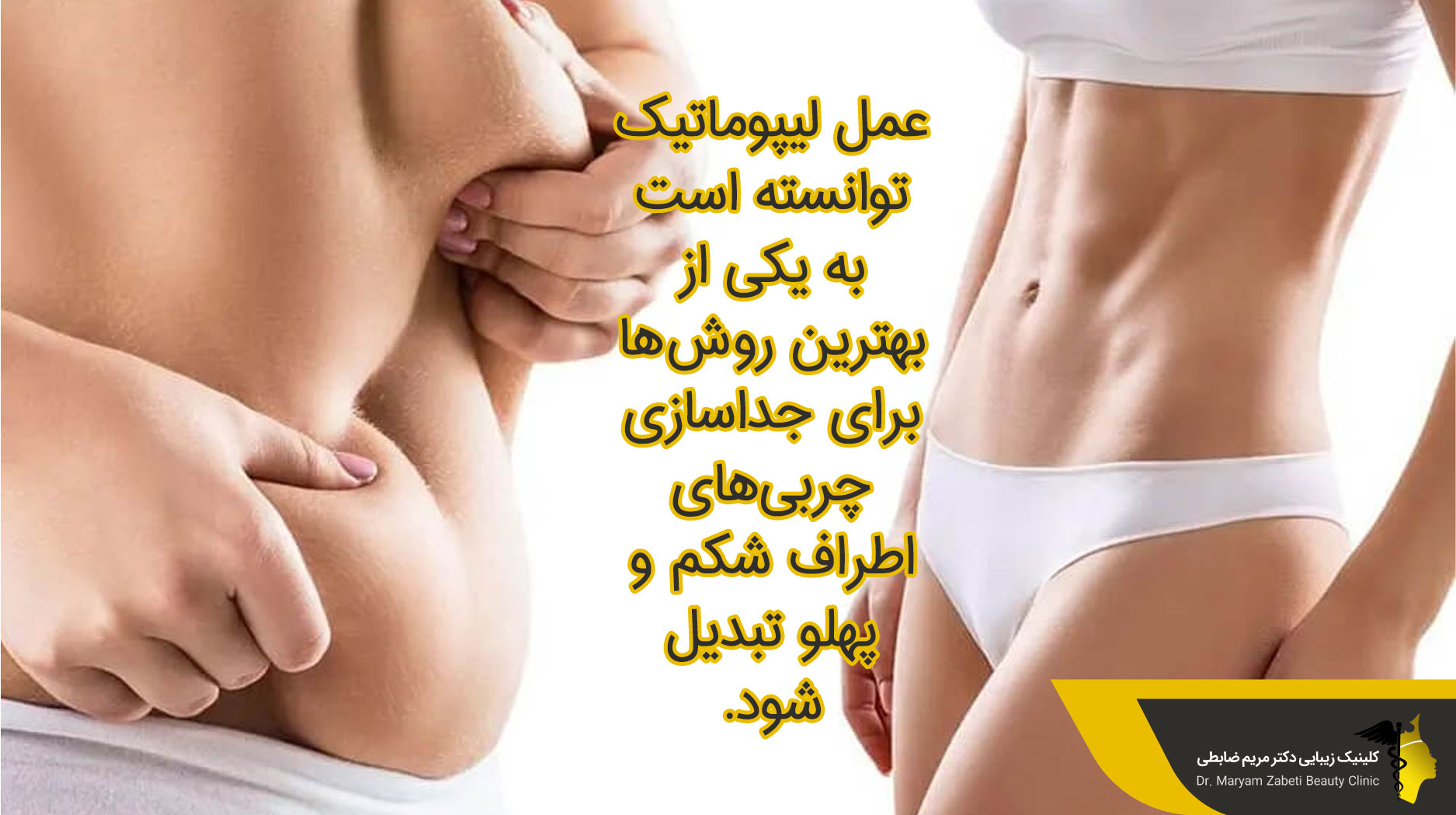 عمل لیپوماتیک