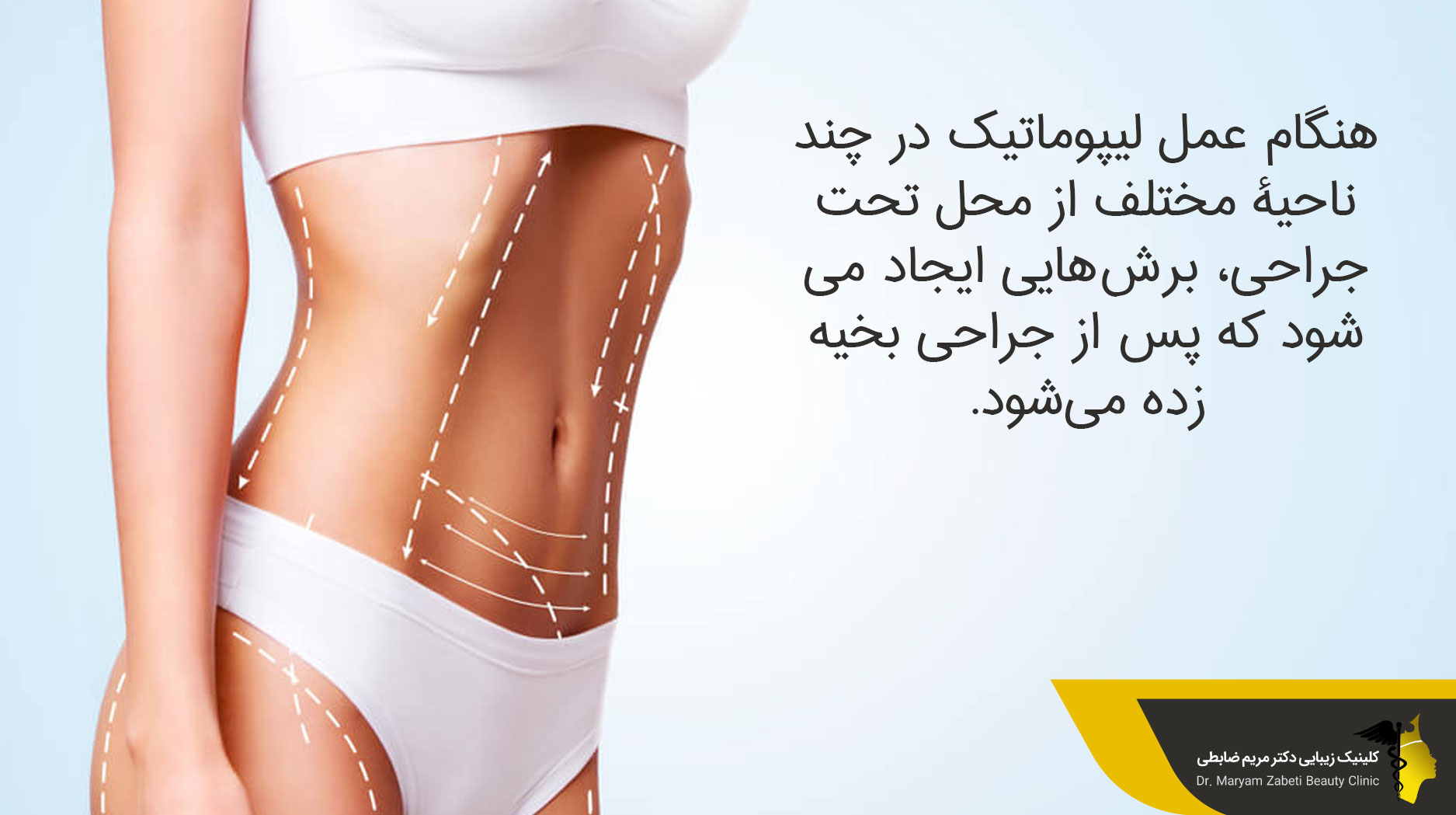  عوارض نبستن گن بعد از لیپوماتیک