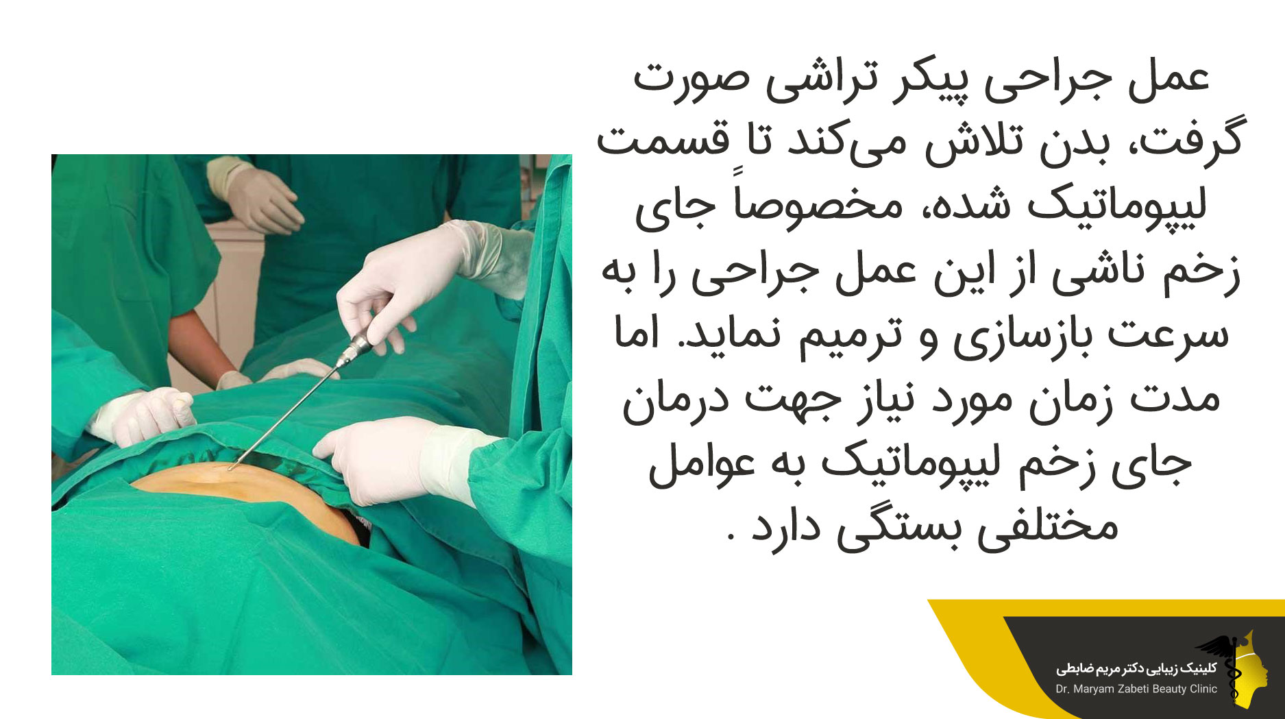 درمان جای زخم لیپوماتیک