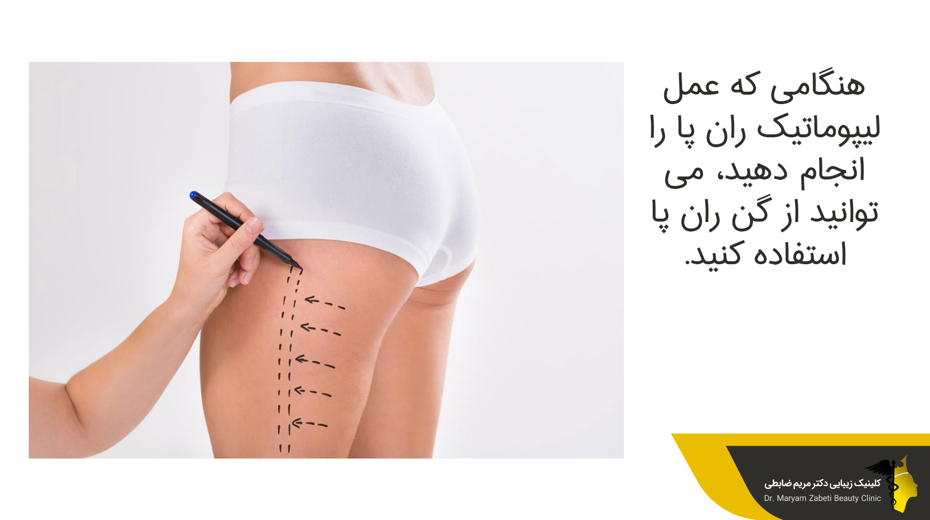 گن لیپوماتیک بازو و ران 