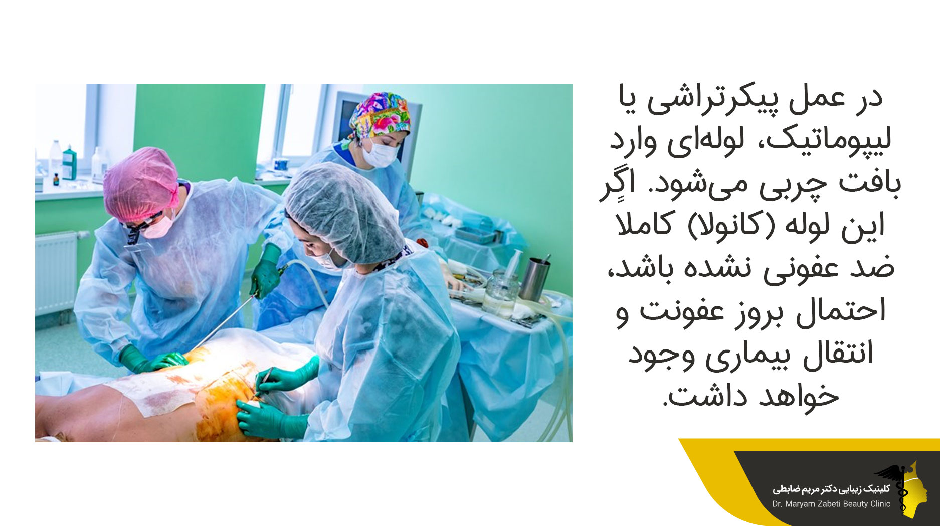احتمال بروز عفونت در لیپوماتیک