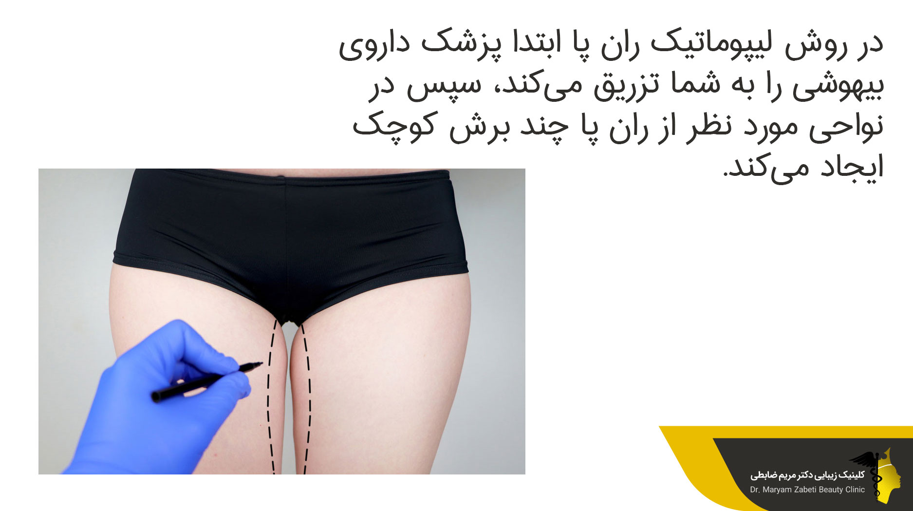 روش انجام پیکرتراشی ران