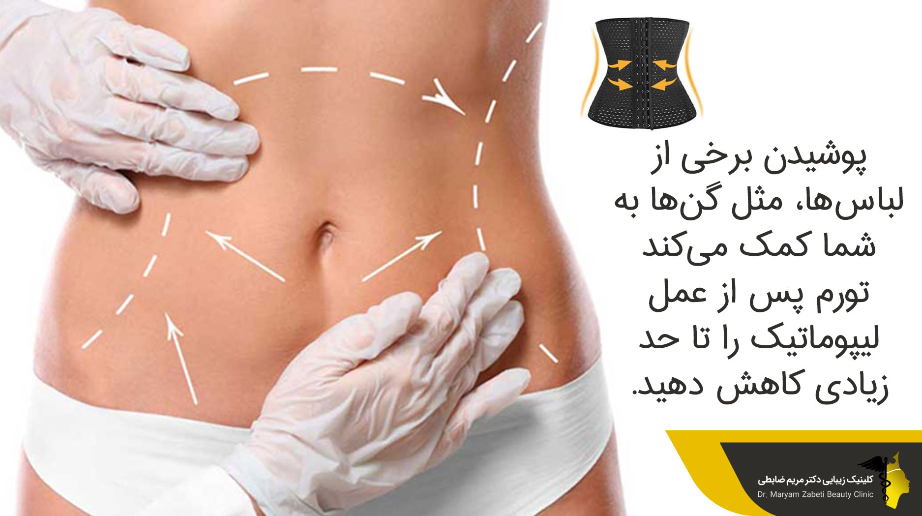 روش های برطرف کردن ورم پوست بعد از عمل لیپوماتیک