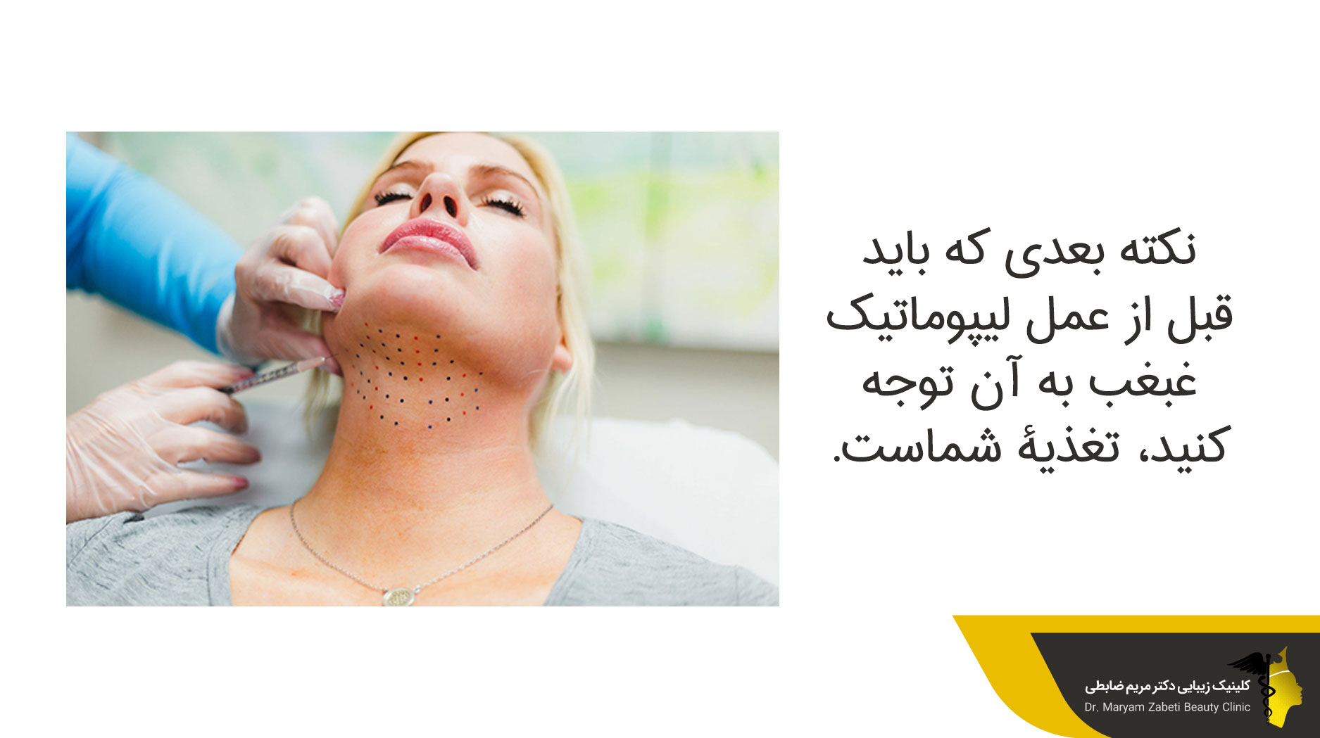  مراقبت‌ های بعد از عمل تخلیه چربی غبغب
