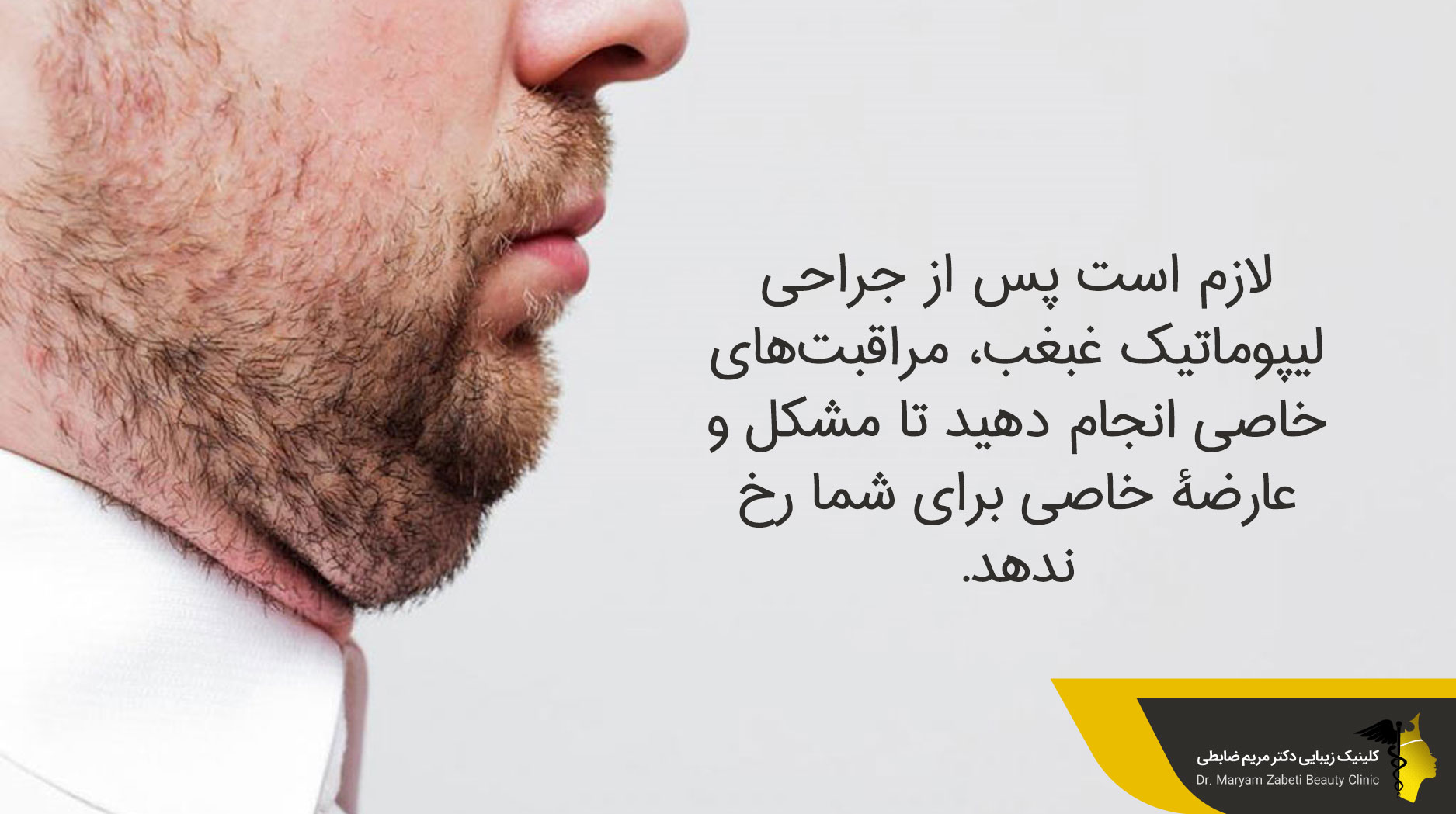 پس از عمل لیپوماتیک غبغب