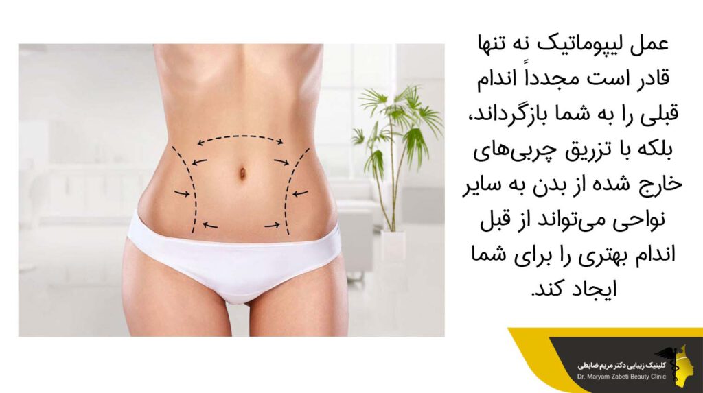 عمل لیپوماتیک و شکل گیری اندامی زیبا