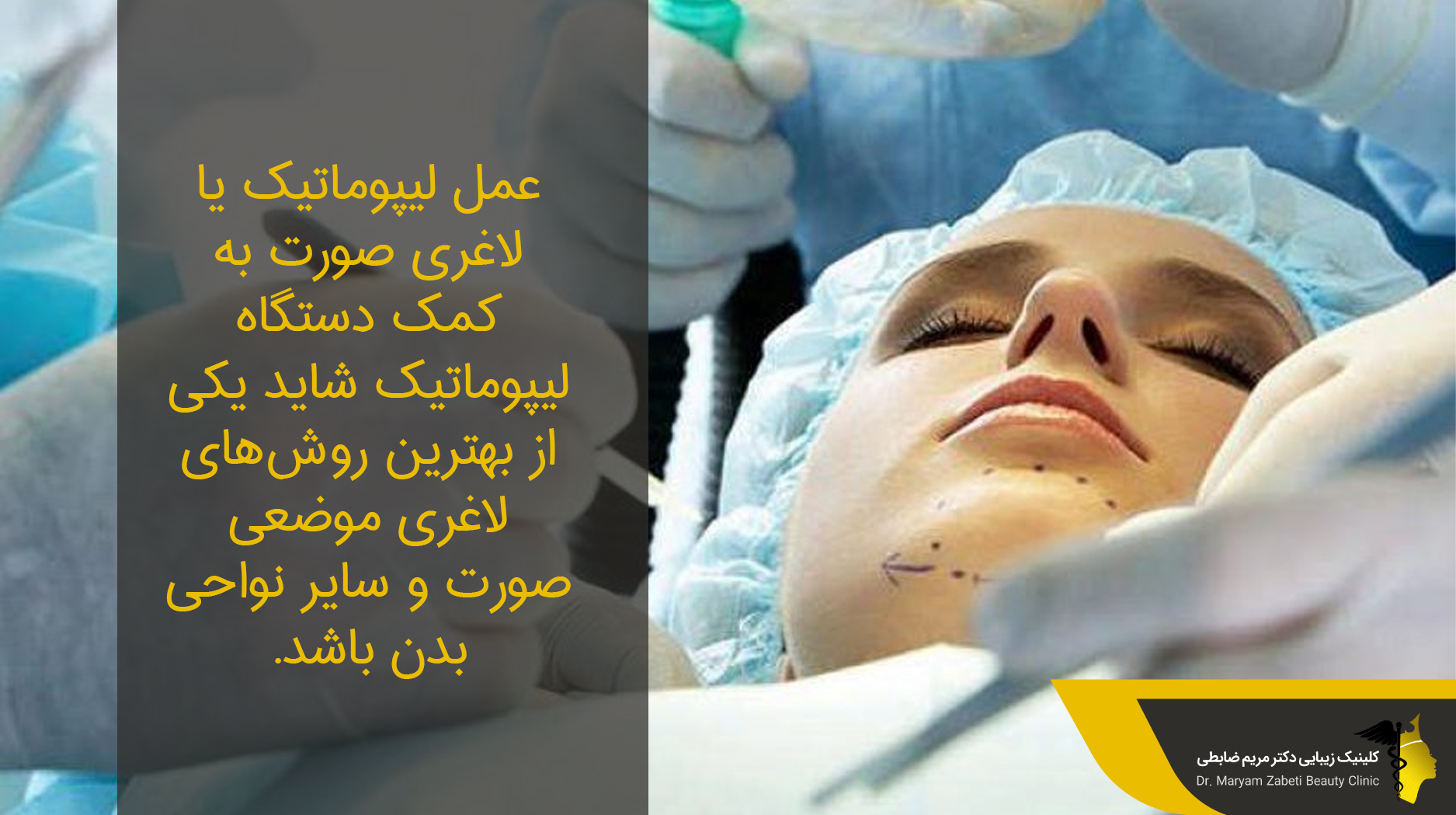 روش نوین چربی زدایی با دستگاه لیپوماتیک