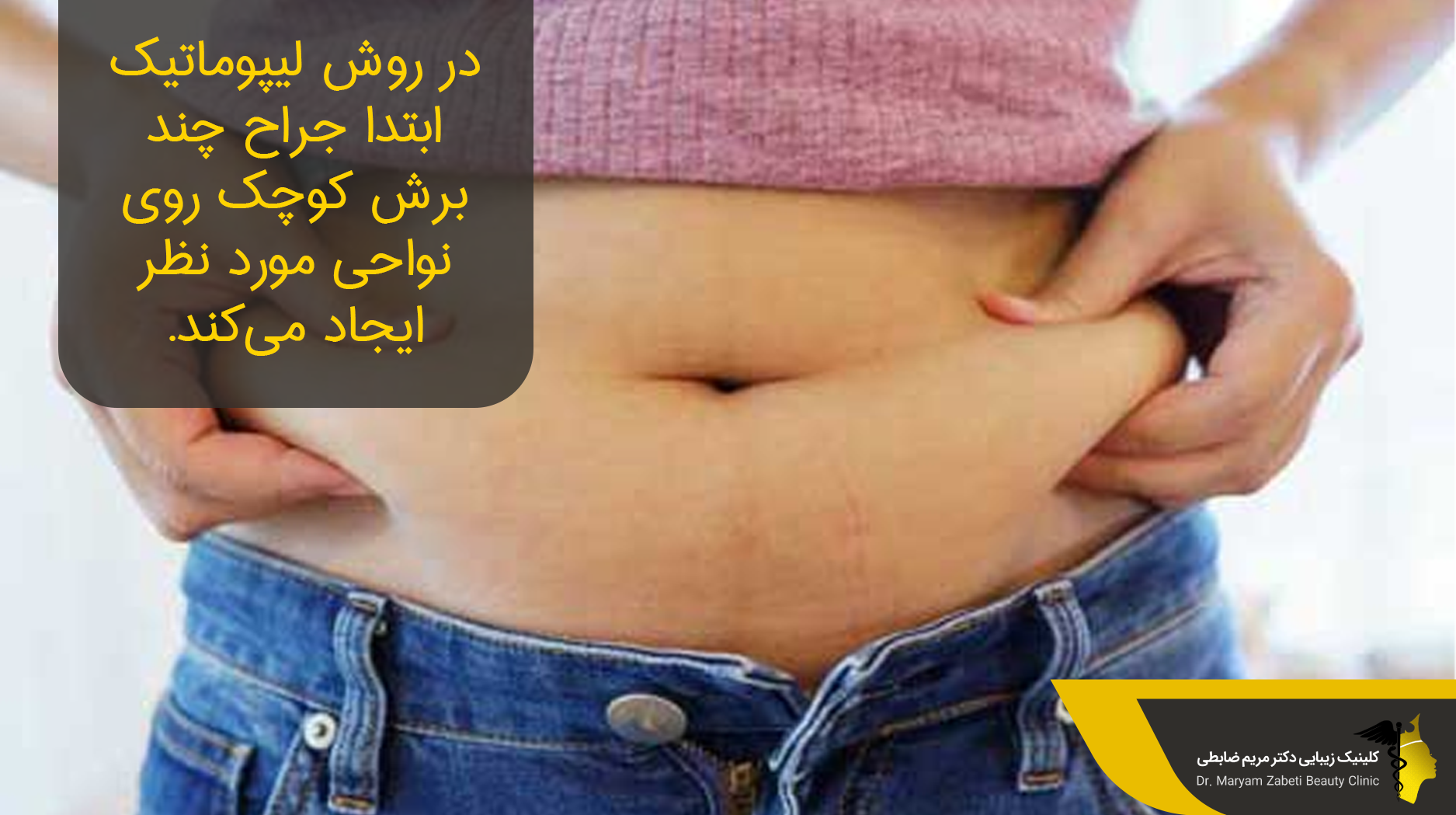  لیپوماتیک چیست 