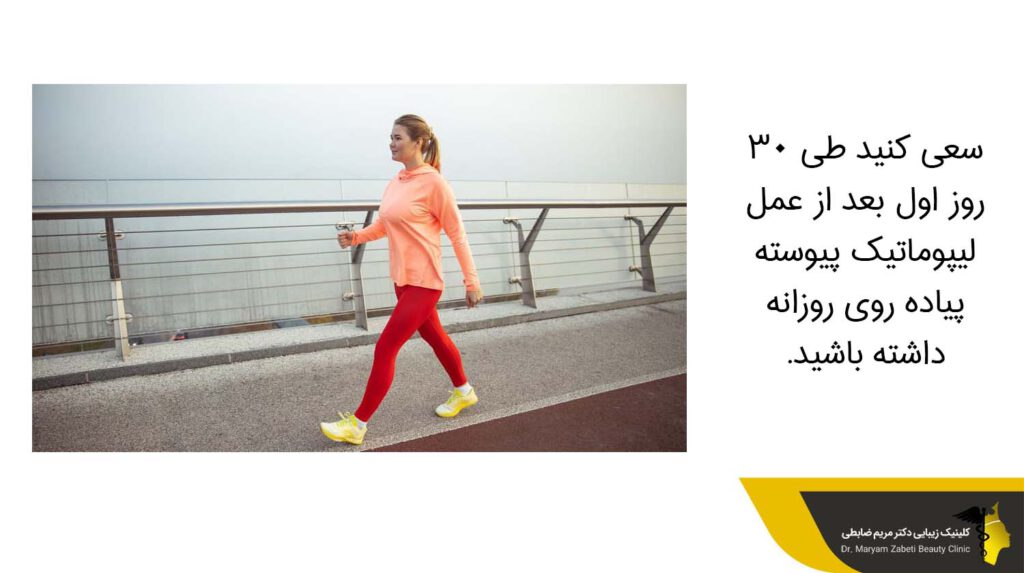 پیاده روی بعد از عمل لیپوماتیک