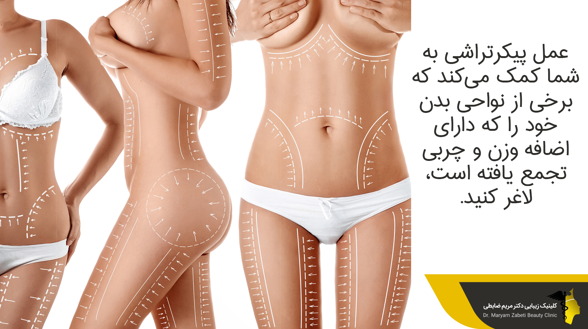 قسمت‌هایی از بدن می‌تواند با لیپوماتیک درمان شود