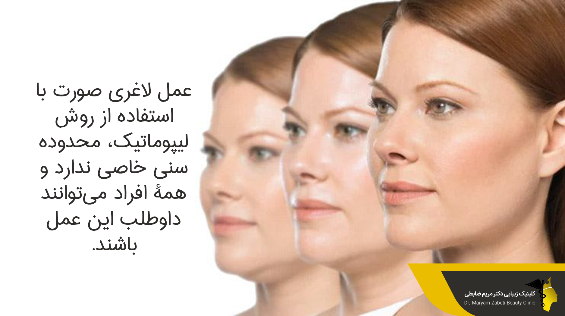  دستگاه لیپوماتیک رهایی از چربی صورت و گردن 