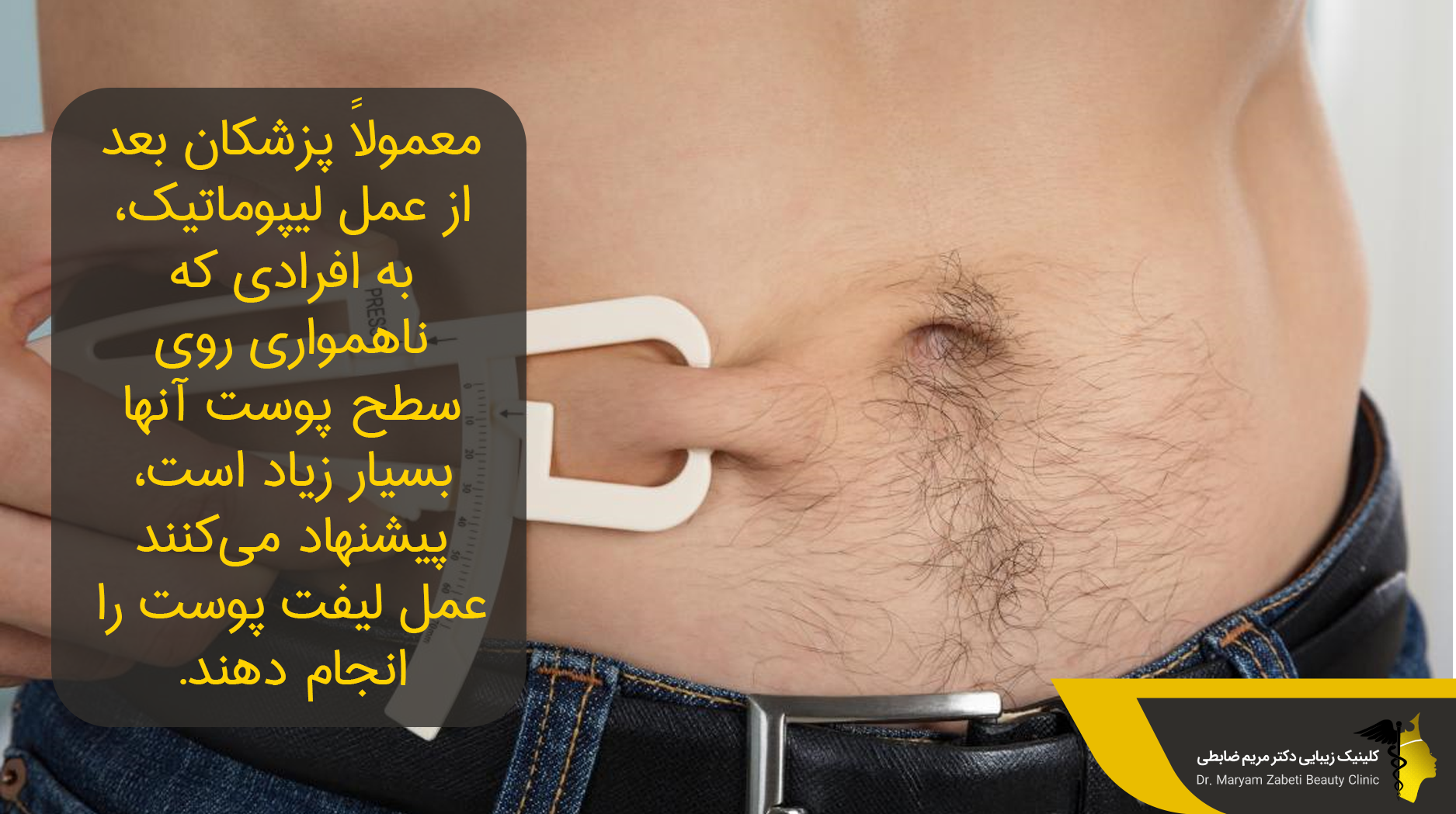 سفت شدن شکم بعد از لیپوماتیک 