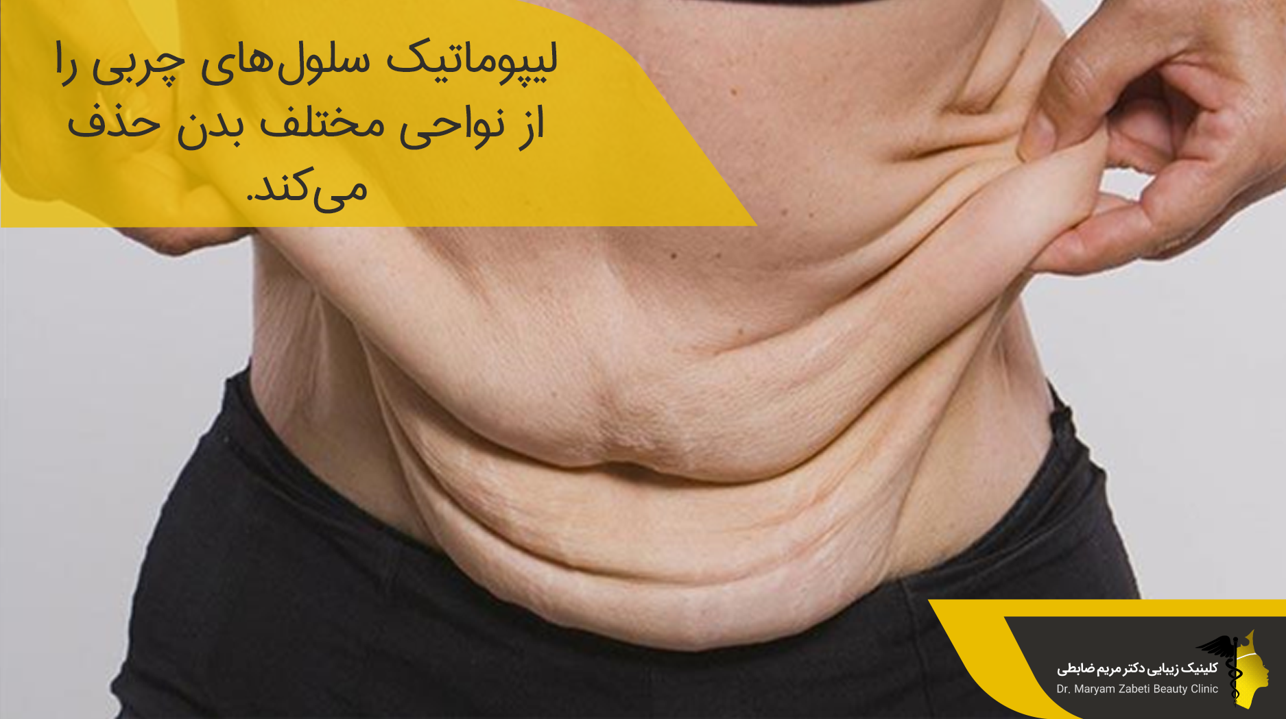 عوارض طولانی مدت لیپوماتیک 