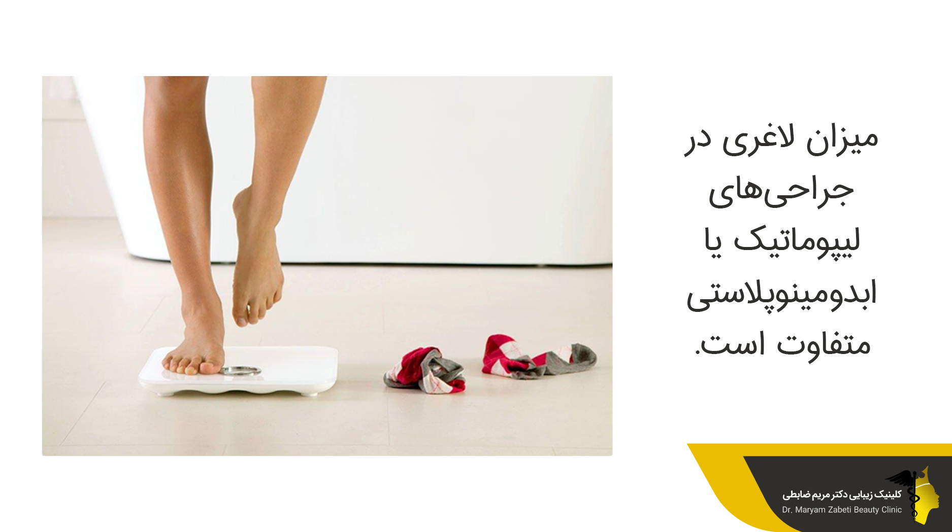 لیپوماتیک و ابدومینوپلاستی برای کاهش چاقی
