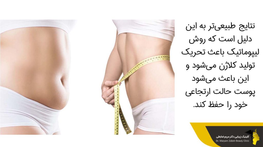 نتایج طبیعی‌تر در روش لیپوماتیک