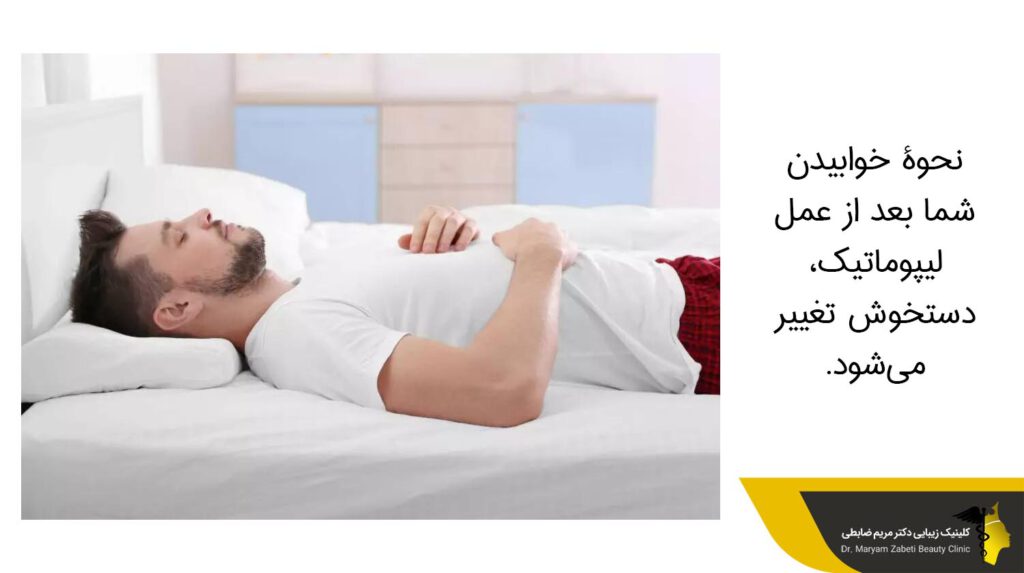 نحوۀ خوابیدن شما بعد از عمل لیپوماتیک، دستخوش تغییر می‌شود.