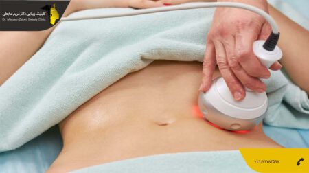 shakheslipo جدیدترین و بهترین روش پیکرتراشی بدون جراحی