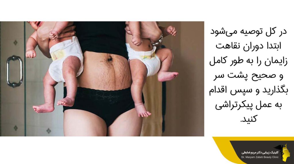 سپری کردن دوران نقاهت پس از زایمان