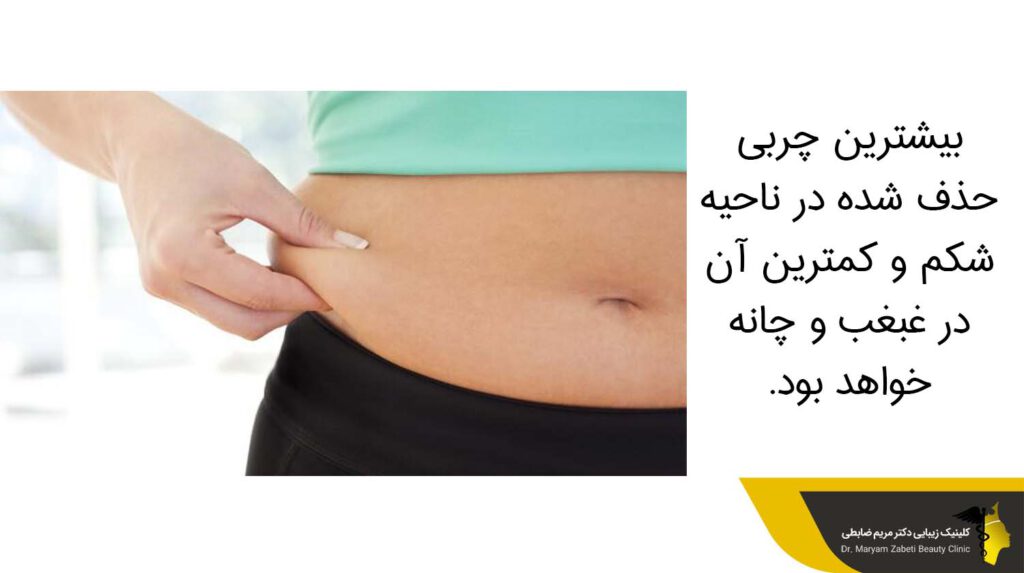 بیشترین چربی حذف شده مربوط به ناحیه شکم است