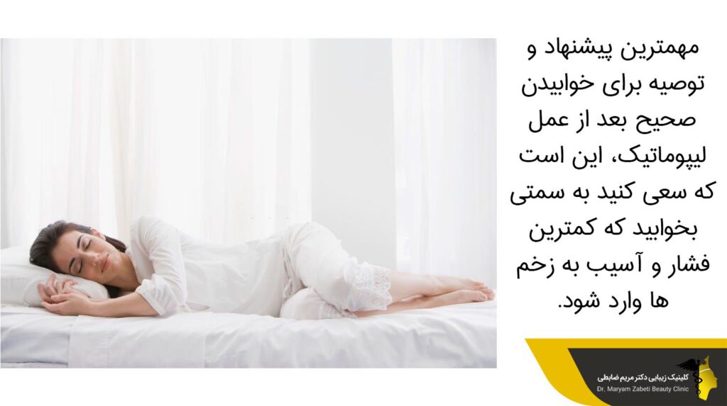 خوابیدن صحیح بعد از عمل لیپوماتیک