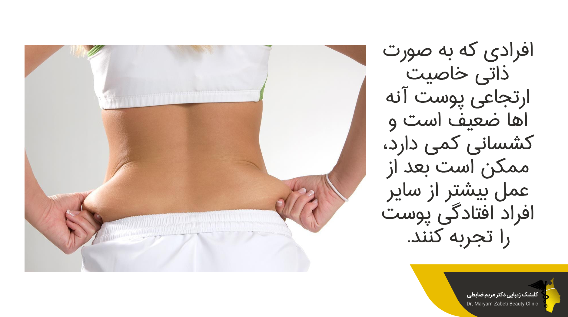 افراد در معرض افتادگی پوست بعد از عمل لیپوماتیک 