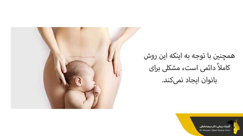 روش لیپوماتیک کاملاً دائمی است