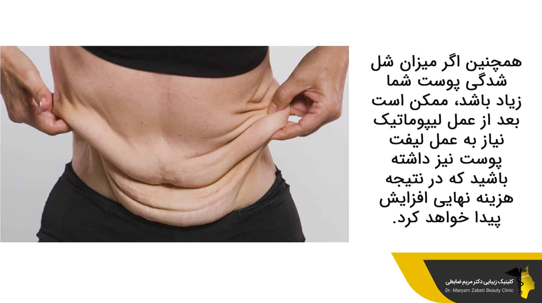 میزان شل شدگی پوست 