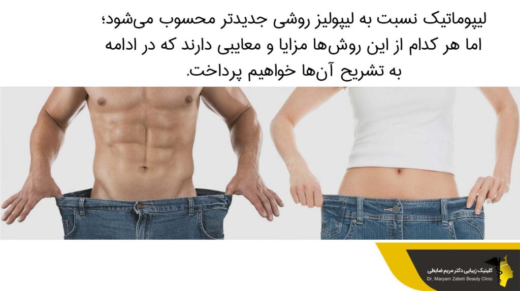 لیپوماتیک نسبت به لیپولیز روشی جدیدتر است