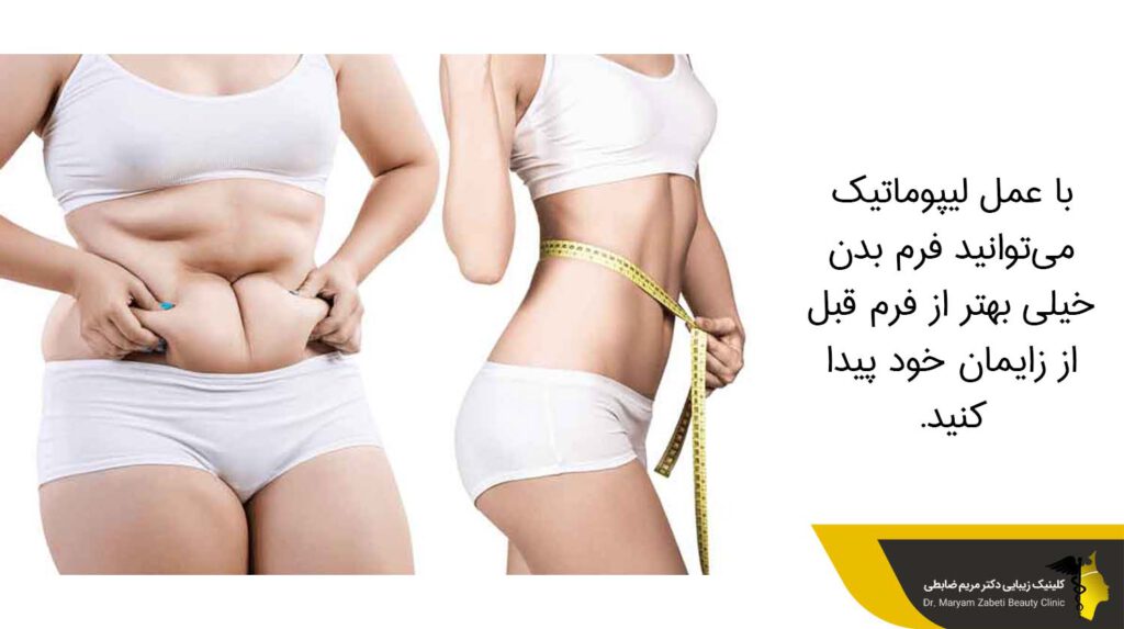 عمل لیپوماتیک و شکل گیری بهترین فرم برای بدن