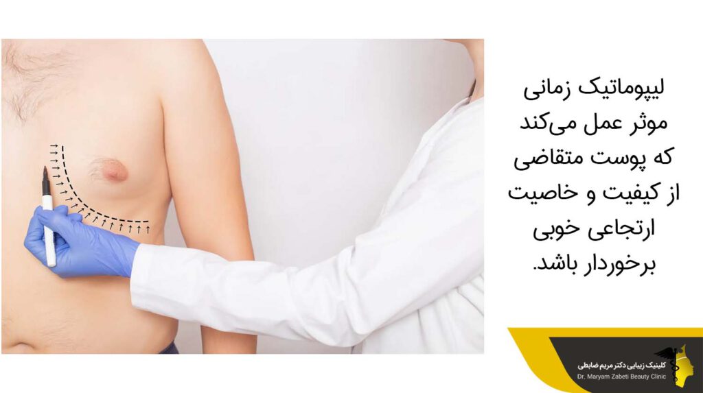 زمان موثر بودن عمل لیپوماتیک