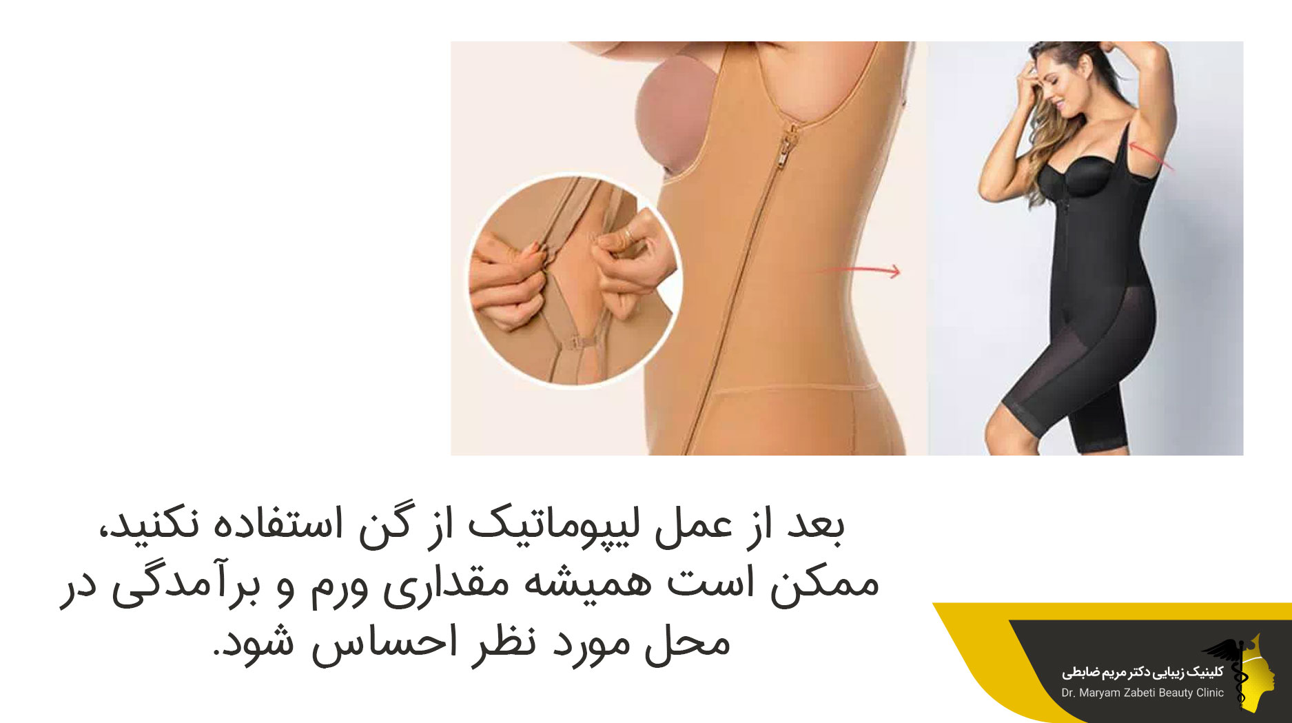 گن بعد از لیپوماتیک