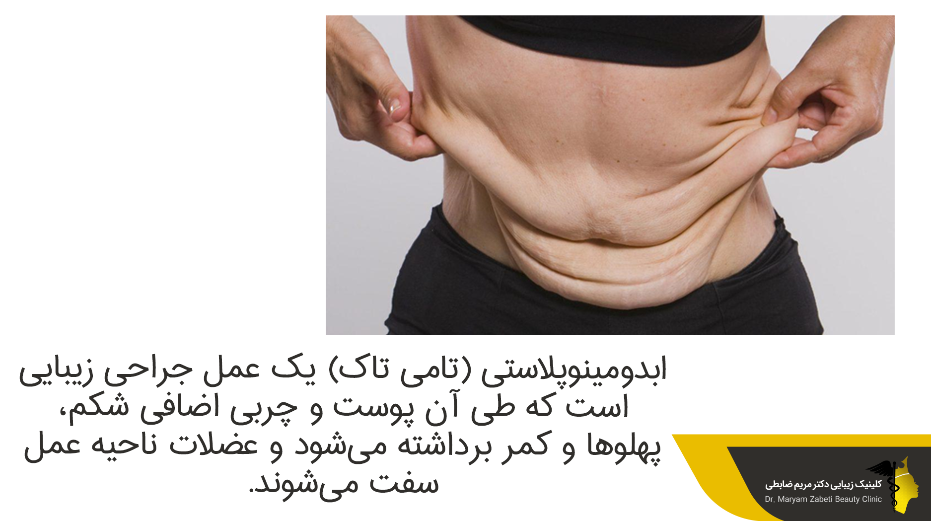 ابدومینوپلاستی و لیپوماتیک 