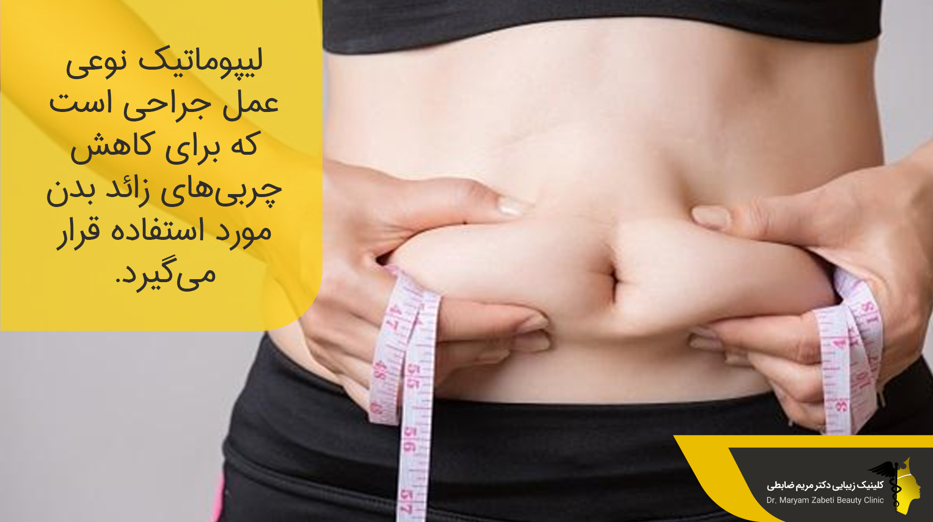 عمل جراحی لیپوماتیک