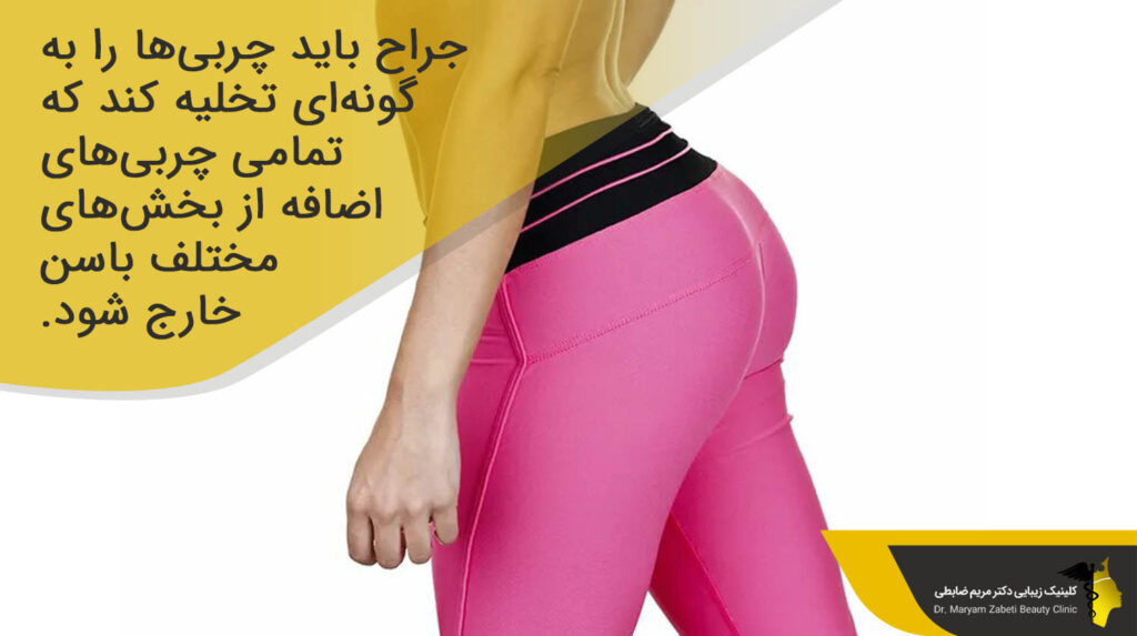 تخلیه چربی ها توسط جراح