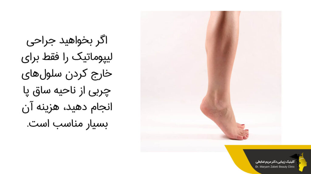 خارج کردن سلول‌های چربی از ناحیه ساق پا 