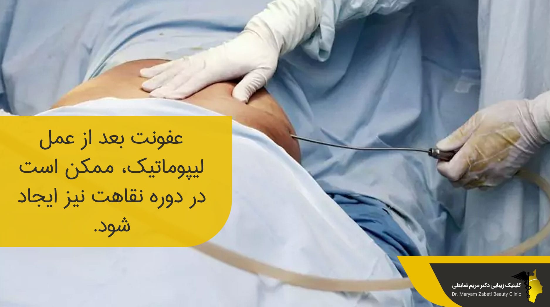 ورود عوامل آلوده به بدن بعد از عمل لیپو