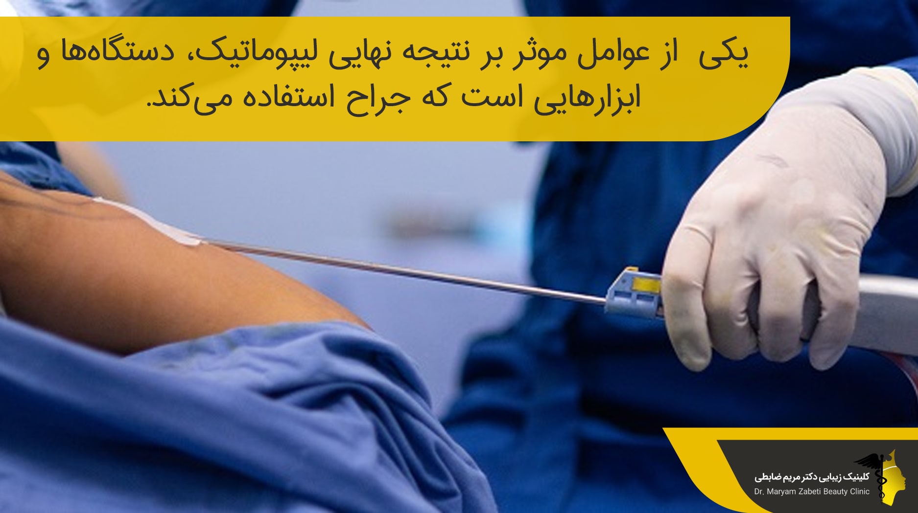 تاثیر دستگاه‌ها بر نتیجه نهایی لیپوماتیک،