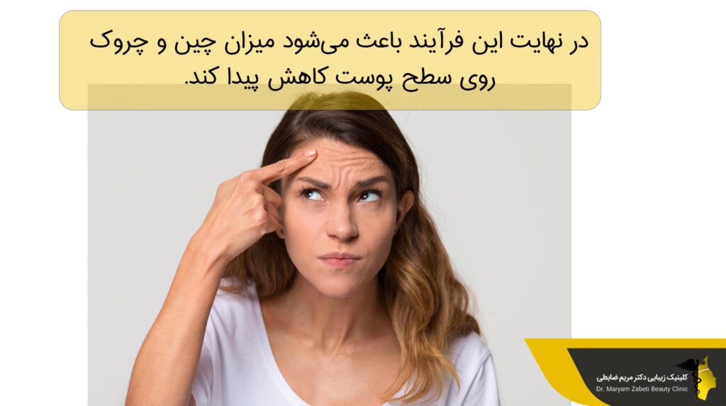 بوتاکس ابرو باتوجه به میزان چین و چروک روی سطح پوست