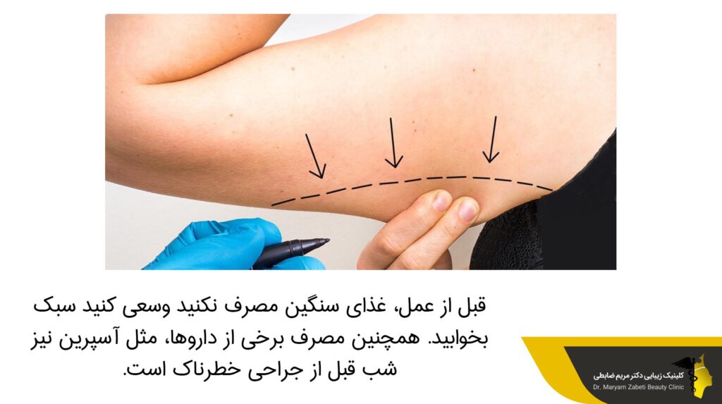قبل از عمل غذای سنگین مصرف نکنید