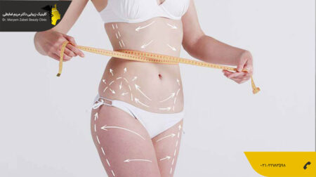 shakheslipo فرق پال با لیپوماتیک