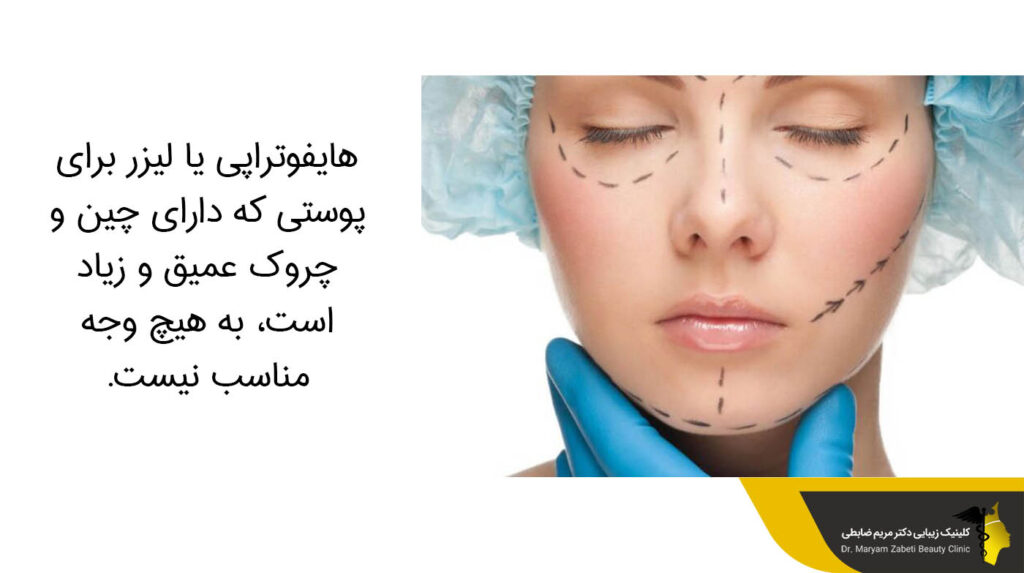 روش غیر تزریقی هایفوتراپی و لیزر 