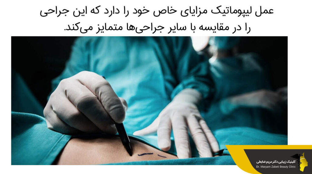 مزایای عمل لیپوماتیک 