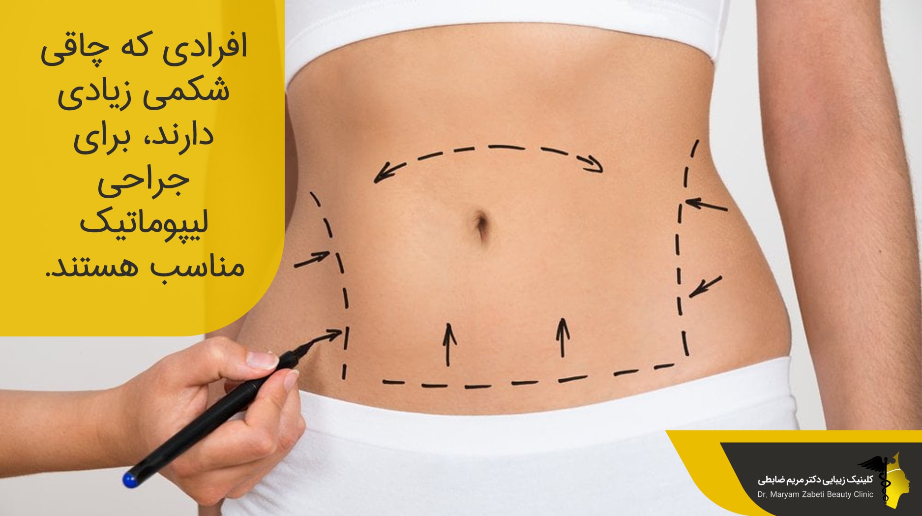 لیپوماتیک برای از بین بردن چربی‌ها