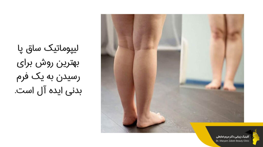 لیپوماتیک ساق پا 