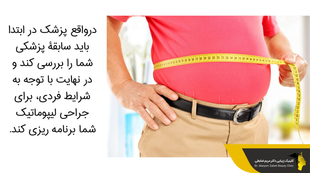جراحی لیپوماتیک و سوابق پزشکی